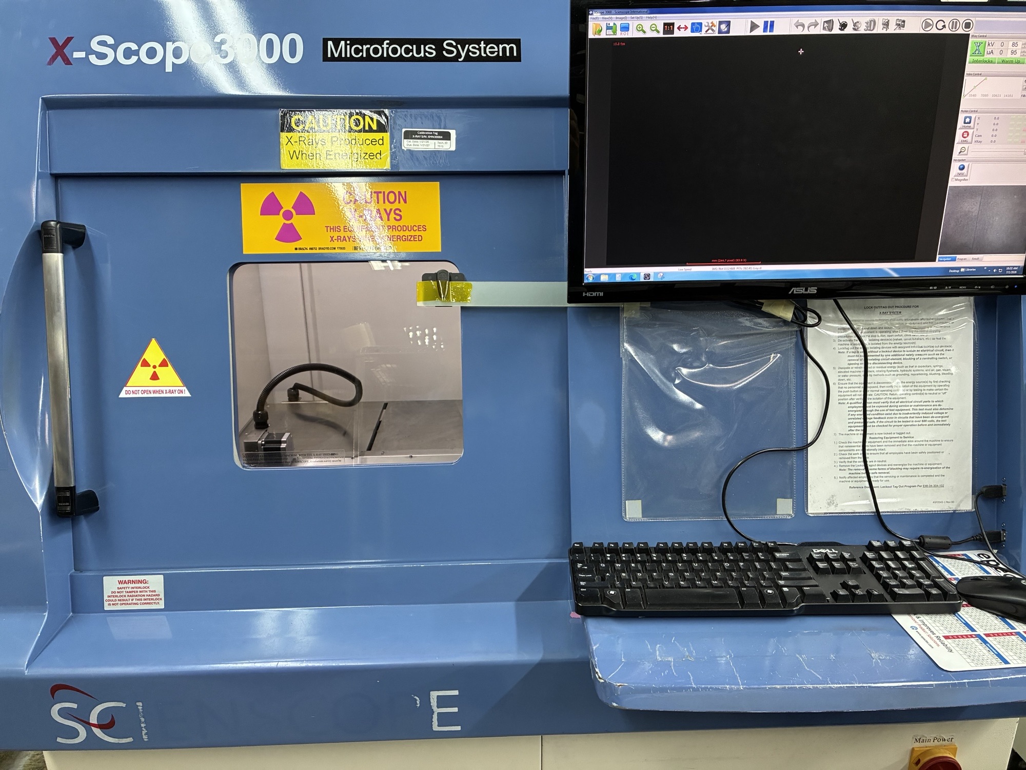 Scienscope X-Ray Machine